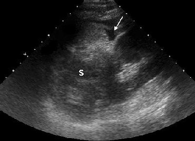 2004 12 14 12 14 19 706