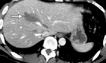 2004 12 14 12 14 55 706