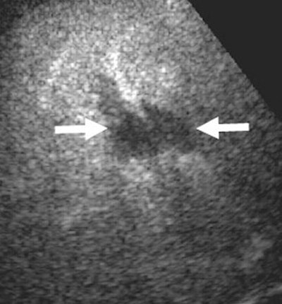 2004 12 14 12 16 34 706