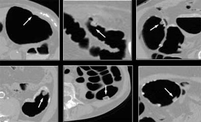 2004 12 21 15 00 05 706