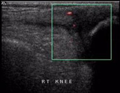 2004 12 28 17 30 34 706