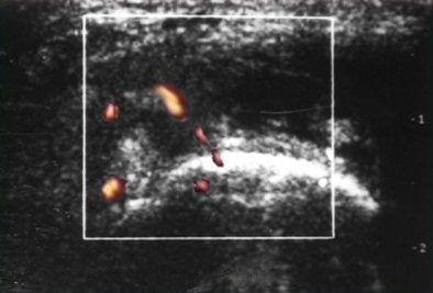 2004 12 28 17 31 32 706