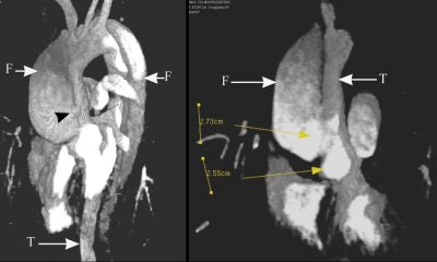 2004 12 29 15 47 56 706