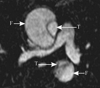 2004 12 29 15 50 04 706