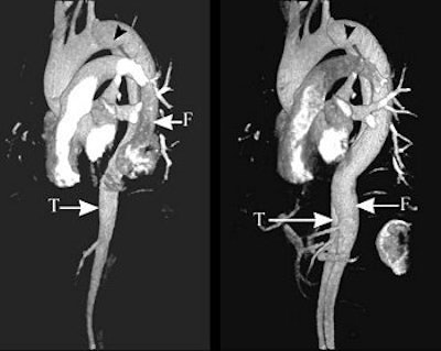 2004 12 29 15 54 23 706