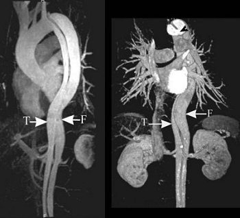 2004 12 29 15 54 44 706