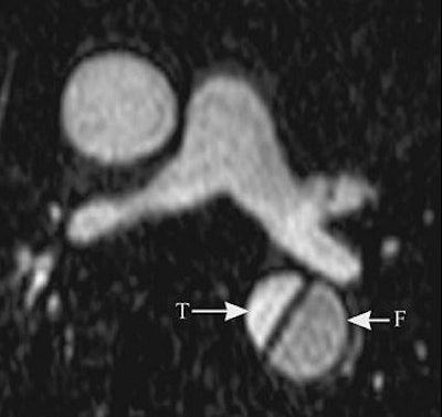 2004 12 29 15 54 58 706