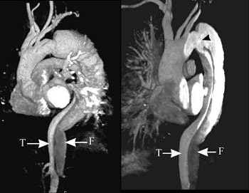 2004 12 29 16 01 37 706