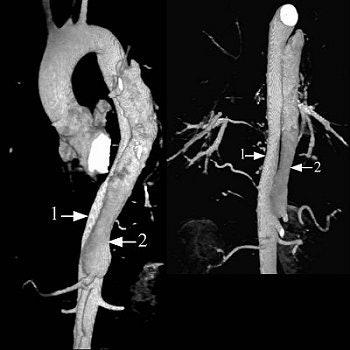 2004 12 29 16 06 22 706