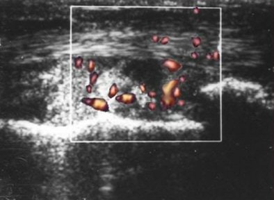 2004 12 28 17 31 15 706