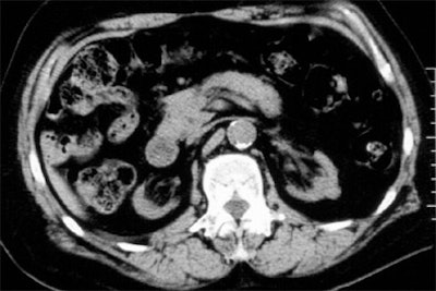 2005 01 04 15 40 42 706