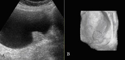 2005 01 06 18 29 30 706