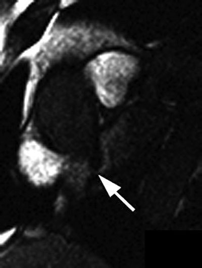 2005 01 07 14 35 22 706