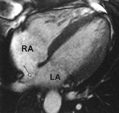 2005 01 07 14 35 46 706