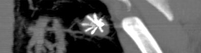 2005 01 07 17 40 07 706