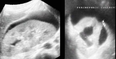 2005 01 10 10 56 18 706