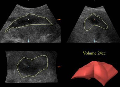 2005 01 10 10 56 58 706