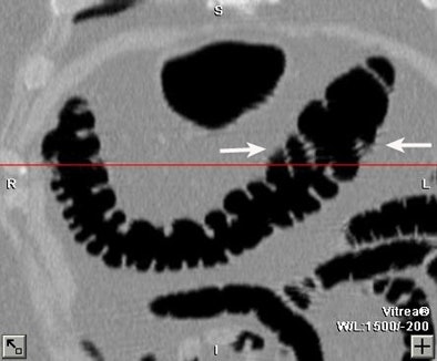 2005 01 14 12 49 53 706