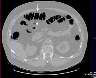 2005 01 14 12 58 08 706