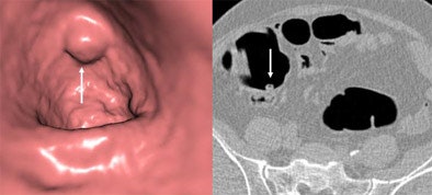 2005 01 14 13 35 06 706