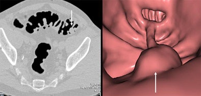 2005 01 14 13 35 24 706