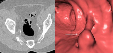 2005 01 14 13 35 56 706