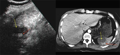 2005 01 20 16 44 06 706