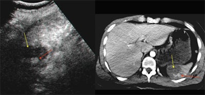 2005 01 20 16 44 06 706