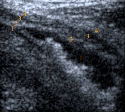 2005 02 07 11 34 41 706