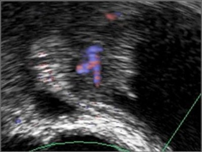 2005 02 07 11 35 08 706