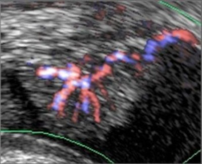 2005 02 07 11 35 27 706