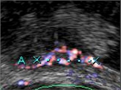 2005 02 07 11 35 47 706