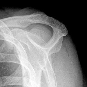 2005 02 17 10 44 55 706