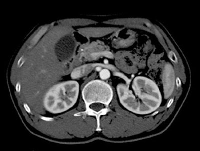 2005 02 18 12 49 34 706