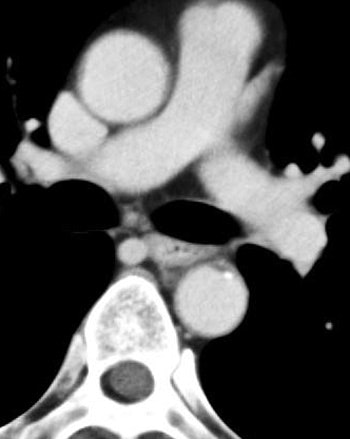 2005 02 22 17 16 14 706