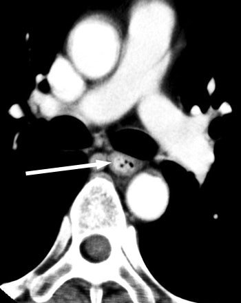 2005 02 22 17 17 03 706