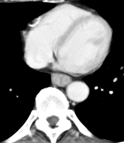 2005 02 22 17 17 22 706