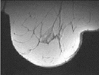 2005 03 14 13 34 16 706