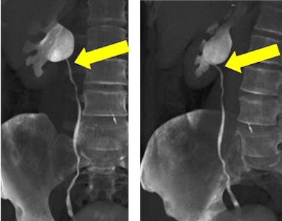 2005 03 17 15 25 17 706