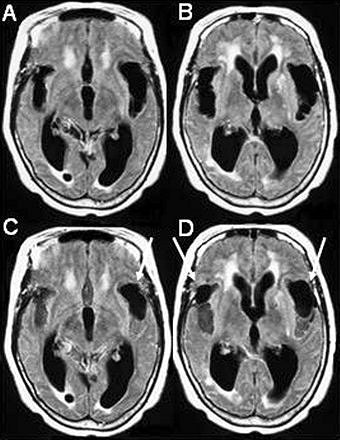 2005 03 23 14 39 18 706