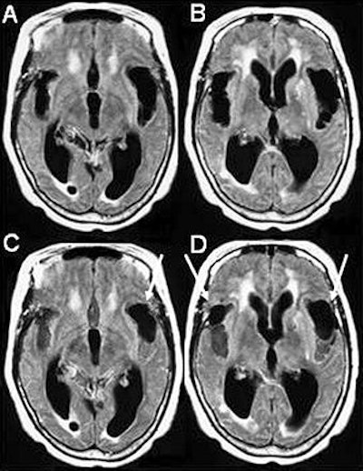 2005 03 23 14 39 18 706