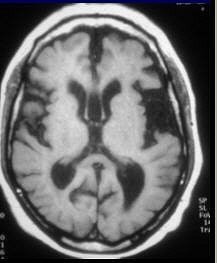 2005 03 23 14 40 06 706