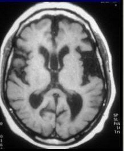 2005 03 23 14 40 06 706