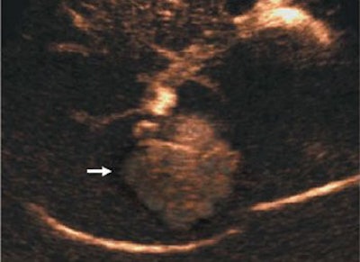 2005 03 25 12 25 40 706