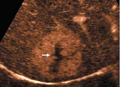 2005 03 25 12 26 07 706