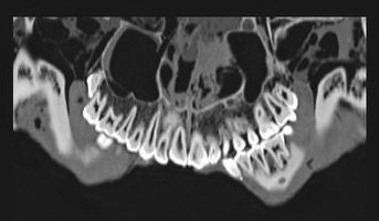 2005 03 28 15 27 15 706