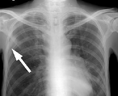 2005 03 30 15 44 29 706