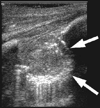 2005 03 30 15 44 48 706