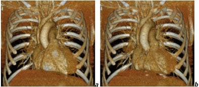 2005 04 01 15 09 09 706