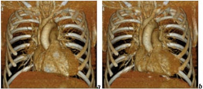 2005 04 01 15 09 09 706